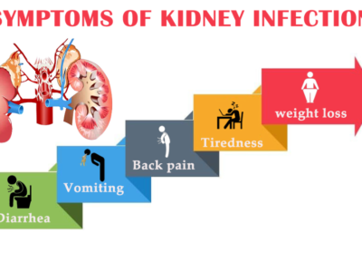 Kidney Infection